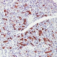 Cytokeratin 7 Mouse Monoclonal Antibody