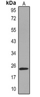 Claudin 3 Mouse Monoclonal Antibody
