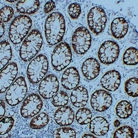 Claudin 3 Mouse Monoclonal Antibody