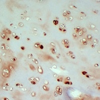 Collagen 2 alpha 1 Antibody