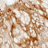 Collagen 2 alpha 1 Antibody
