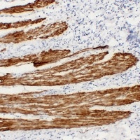 Desmin Mouse Monoclonal Antibody