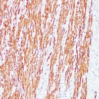 Desmin Mouse Monoclonal Antibody
