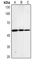 Fascin Mouse Monoclonal Antibody