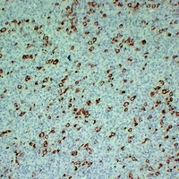 Fascin Mouse Monoclonal Antibody