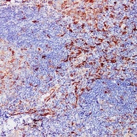 Fascin Mouse Monoclonal Antibody