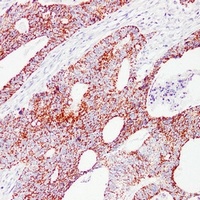 HSP60 Antibody