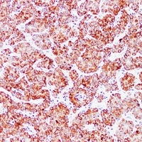HSP60 Antibody