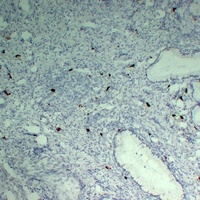 TPSAB1 Antibody