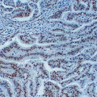 MSH6 Mouse Monoclonal Antibody