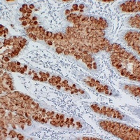 MUC2 Mouse Monoclonal Antibody