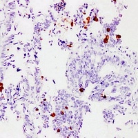 MUC2 Mouse Monoclonal Antibody