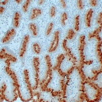 MUC5AC Mouse Monoclonal Antibody