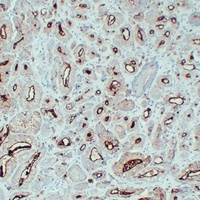 PSMA Mouse Monoclonal Antibody