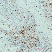 S100-A4 Mouse Monoclonal Antibody