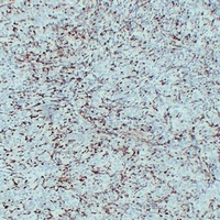 S100-A4 Mouse Monoclonal Antibody