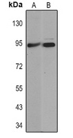Villin Mouse Monoclonal Antibody