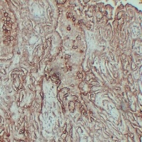 MUC16 Mouse Monoclonal Antibody