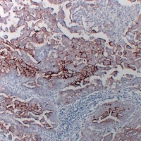 MUC16 Mouse Monoclonal Antibody