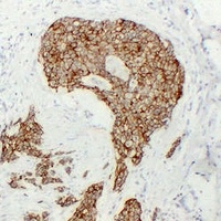 Cadherin pan Mouse Monoclonal Antibody
