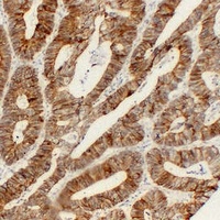 Cadherin pan Mouse Monoclonal Antibody