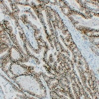 Claudin 7 Antibody