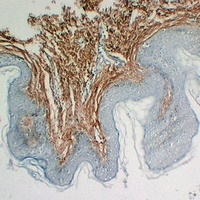 Collagen 3 alpha 1 Antibody