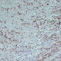 S100-A4 Mouse Monoclonal Antibody