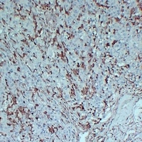S100-A4 Mouse Monoclonal Antibody