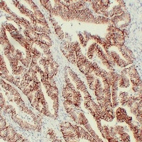 Claudin 7 Antibody