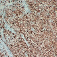 Tyrosinase Mouse Monoclonal Antibody