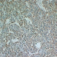 Tyrosinase Mouse Monoclonal Antibody