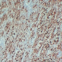 Tyrosinase Mouse Monoclonal Antibody