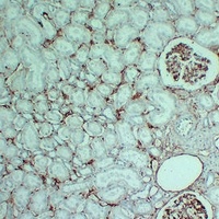 CD105 Mouse Monoclonal Antibody