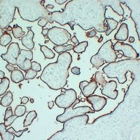 CD105 Mouse Monoclonal Antibody