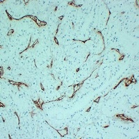 CD105 Mouse Monoclonal Antibody