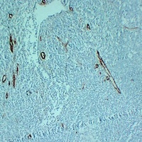 CD105 Mouse Monoclonal Antibody