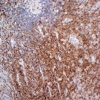 CD38 Mouse Monoclonal Antibody