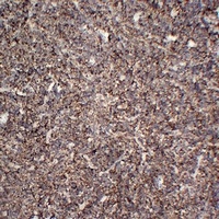 CD38 Mouse Monoclonal Antibody