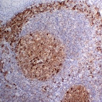 CD38 Mouse Monoclonal Antibody