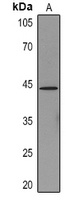 Cytokeratin 19 Mouse Monoclonal Antibody