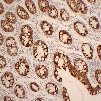 Cytokeratin 19 Mouse Monoclonal Antibody