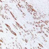 Cytokeratin 19 Mouse Monoclonal Antibody