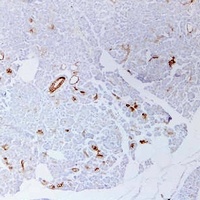 Cytokeratin 19 Mouse Monoclonal Antibody