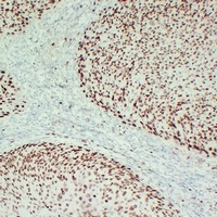 MCM2 Mouse Monoclonal Antibody