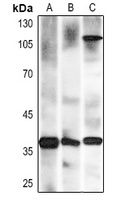 Nucleophosmin Mouse Monoclonal Antibody