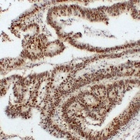 Nucleophosmin Mouse Monoclonal Antibody