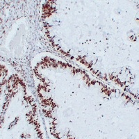 Nucleophosmin Mouse Monoclonal Antibody