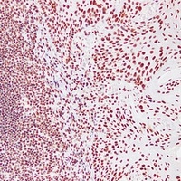 Nucleophosmin Mouse Monoclonal Antibody