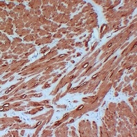 Actin pan Mouse Monoclonal Antibody